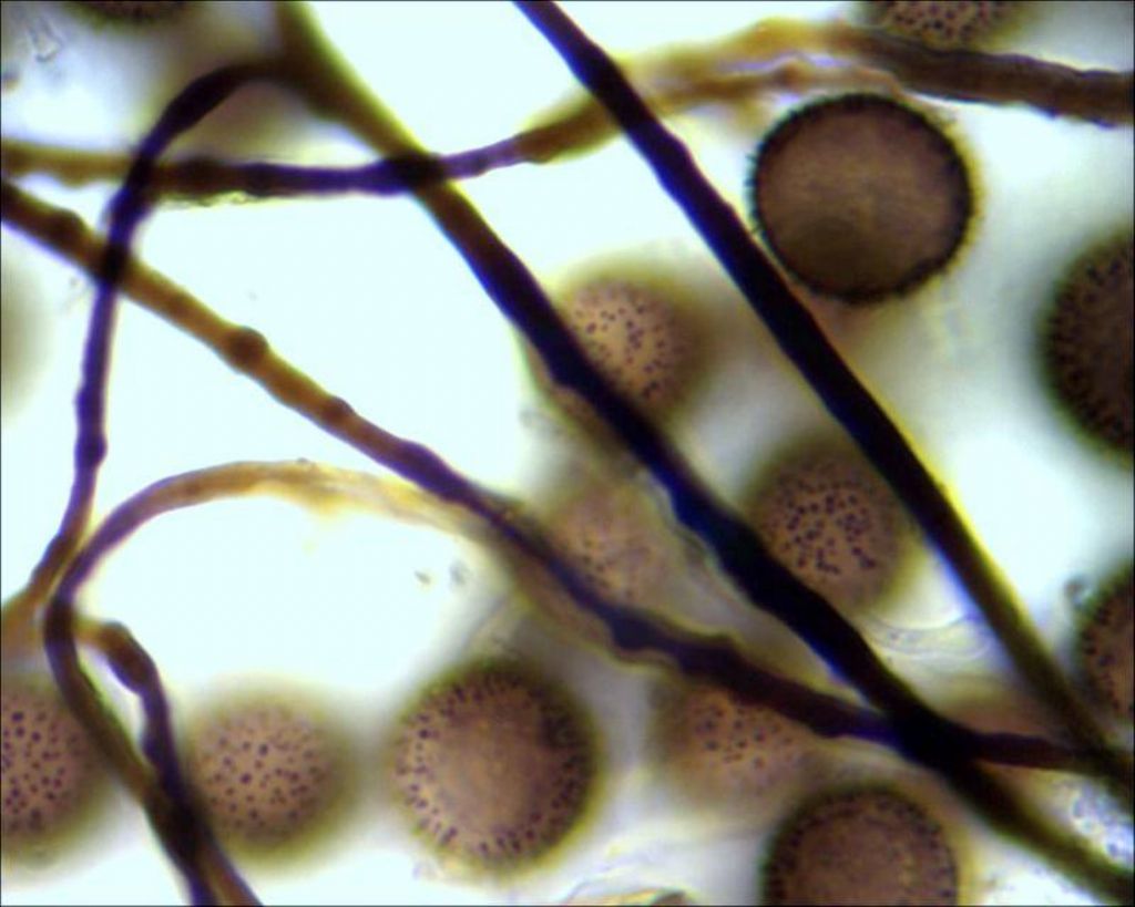 Sconosciuto myxo nivicolous da Olympos